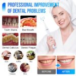 Electric Toothbrush Sonic Dental Scaler Teeth Whitening Kit - Image 11